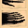 Чудесное открытие Рентгена. Нива 1898г. (3)